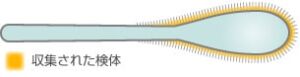 フロックスワブ|収集された検体