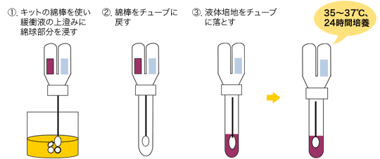 簡易食中毒　検査キットの使い方｜ＳＴチューブ検査